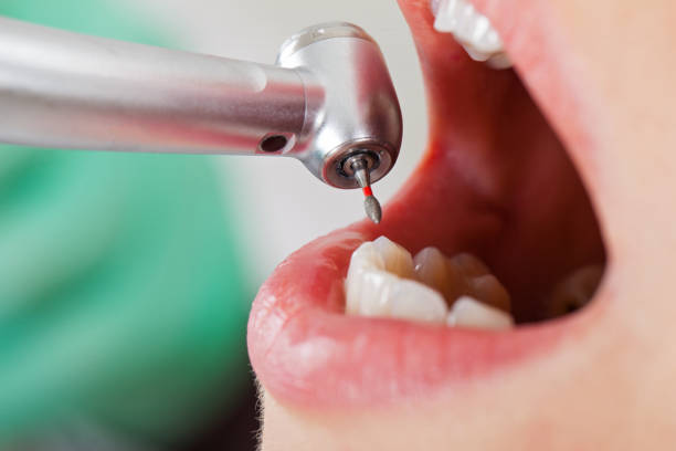 Best Urgent Tooth Repair  in Scottdale, GA